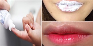 cách trị thâm viền môi