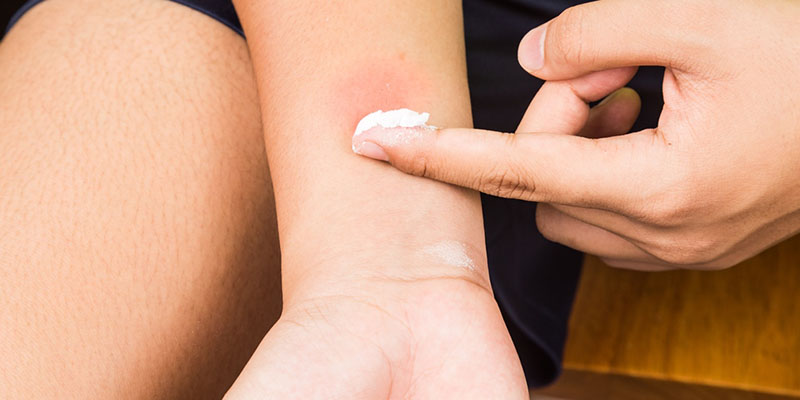 Cơ thể sẽ bị phơi nhiễm hóa chất nếu các vùng da bị vết thương hở tiếp xúc với thuốc chống muỗi.