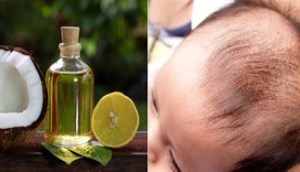 Cách dùng dầu dừa loại bỏ 'cứt trâu' cho bé
