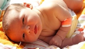 Bệnh galactosemia là gì?