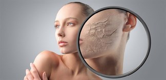 Ăn gì cho da hết sần sùi?