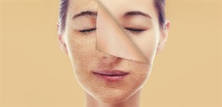 Cách tẩy tế bào chết đơn giản, hiệu quả tại nhà