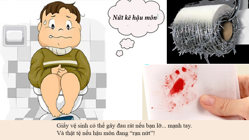 Giấy vệ sinh có thể gây đau rát hậu môn