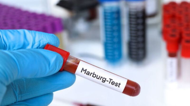 Con đường lây truyền của virus Marburg