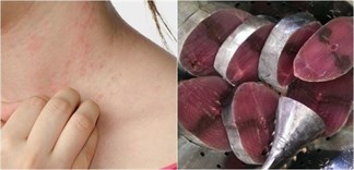 Những người nào không nên ăn cá ngừ?