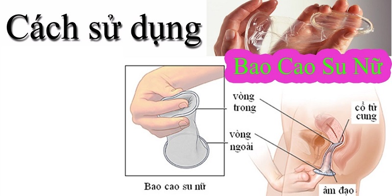 Cách sử dụng bao cao su nữ