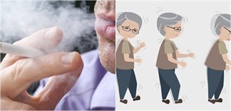 Thuốc lá ngừa bệnh Parkinson, khó tin mà có thật!