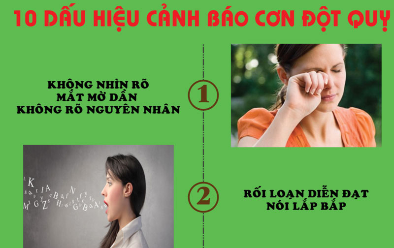 Dấu hiệu cảnh báo đột quỵ