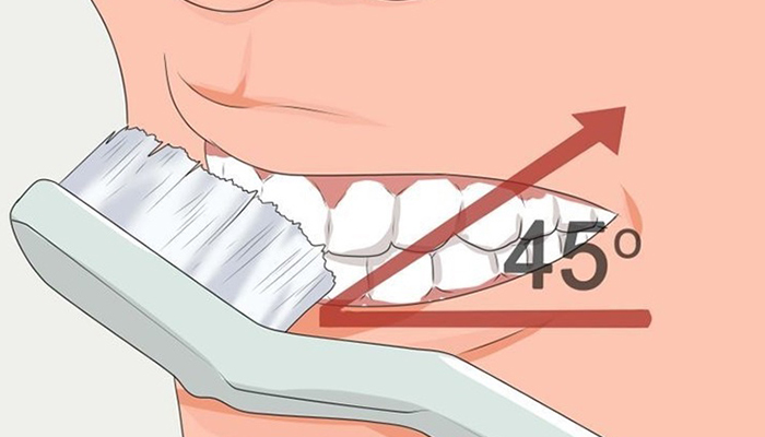 Muốn răng trắng sạch đừng mắc phải những sai lầm này