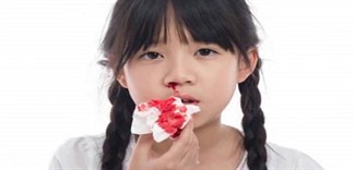 Có phương pháp nào để ngăn ngừa chảy máu ở mũi? 

