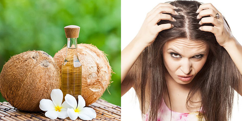 Lạm dụng dầu dừa khiến tóc nhanh bị bết