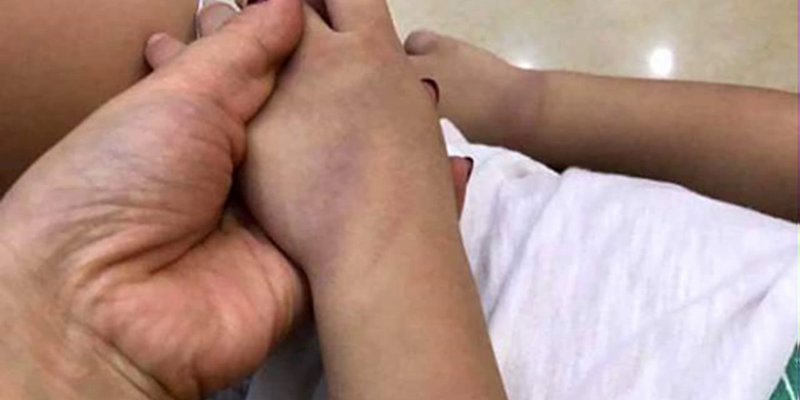 bé bị ngộ độc do ăn quá nhiều củ dền bé bị ngộ độc do ăn quá nhiều củ dền