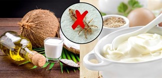 Cách diệt chấy rận bằng Mayonnaise và dầu dừa, bạn đã biết?