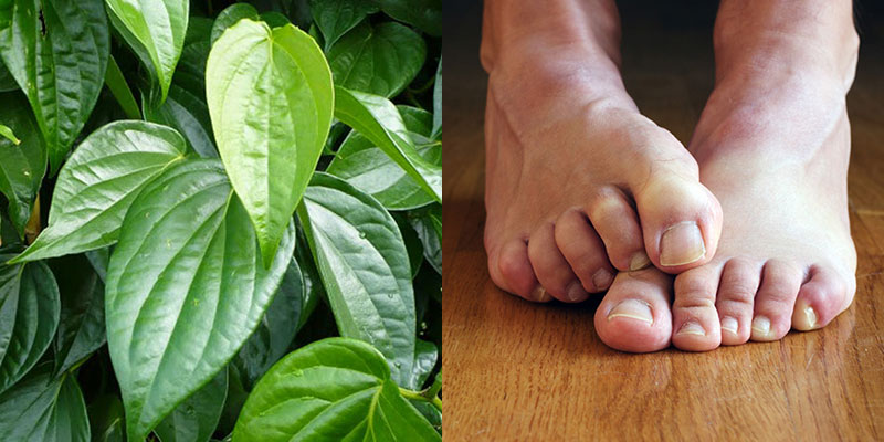 Treating smelly feet with betel leaves