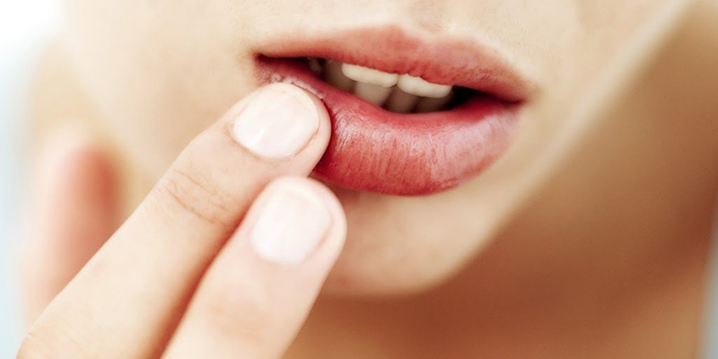 liếm môi còn gây cho môi đau rát, bong tróc da, viêm da