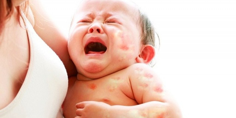dị ứng sữa công thức ở trẻ sẽ gây ra rất nhiều tác hại dị ứng sữa công thức ở trẻ sẽ gây ra rất nhiều tác hại