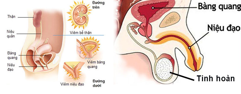 Viêm niệu đạo là gì, nguyên nhân, triệu chứng, điều trị