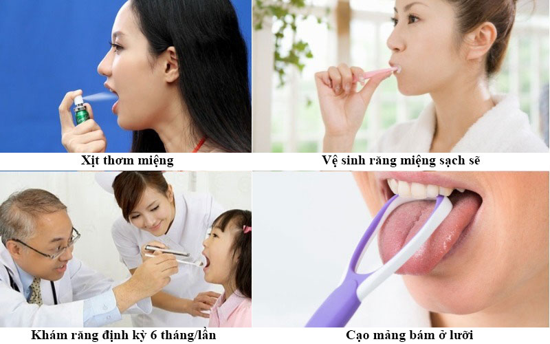 Điều trị hôi miệng