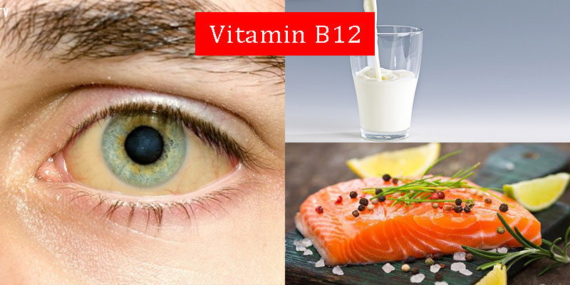 Mắt vàng là thiếu vitamin B12