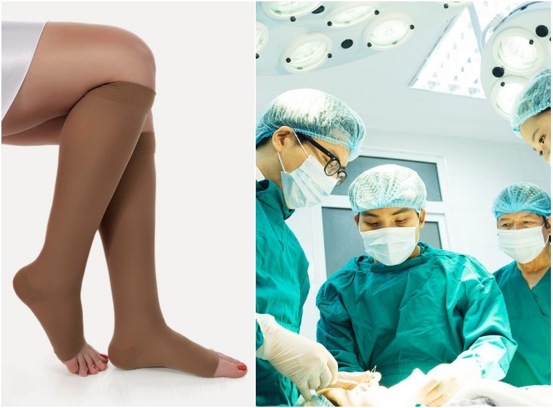 Điều trị suy giãn tĩnh mạch