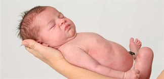 Bí quyết chăm sóc da cho trẻ sơ sinh đúng cách