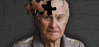 Có những thói quen hàng ngày nào có thể giúp giảm nguy cơ mắc bệnh Alzheimer?
