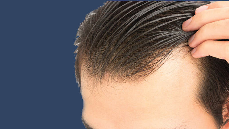 Cách gội đầu và chăm sóc từng loại tóc cho nam giới