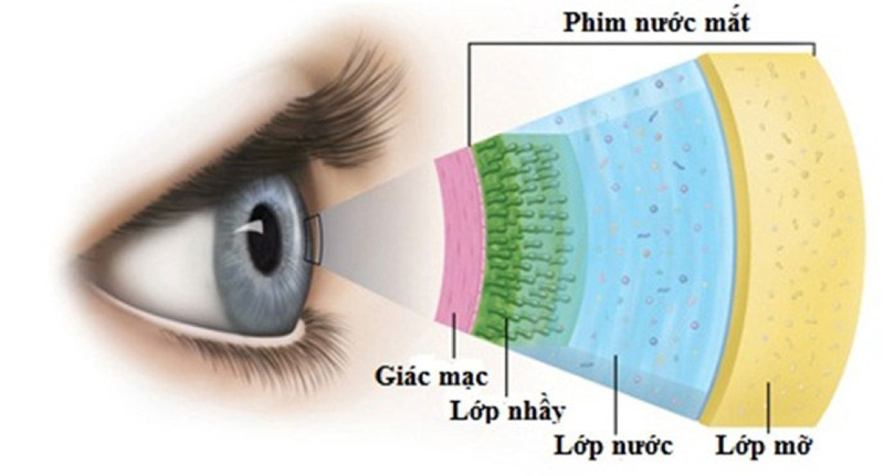 Khô và nhức mỏi mắt là gì?