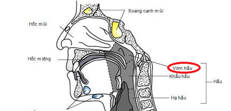 Ung thư vòm hầu