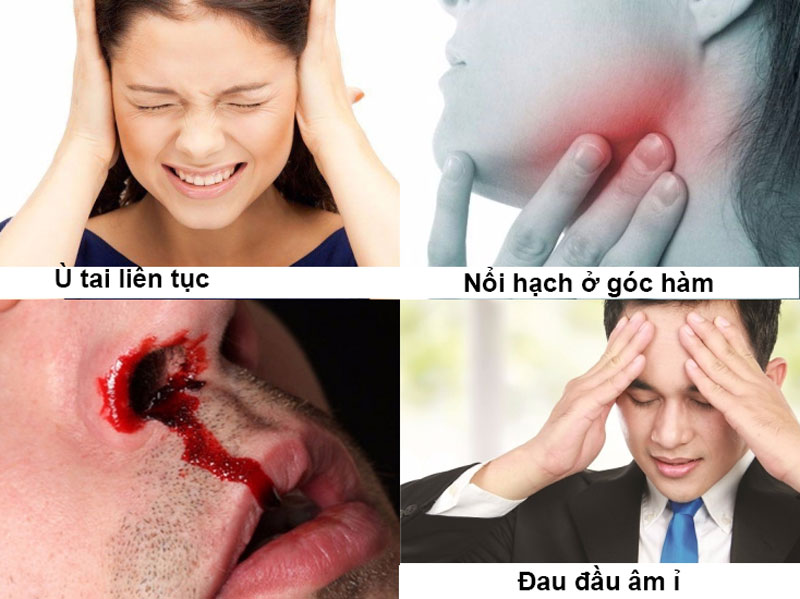 Triệu chứng của ung thư vòm hầu