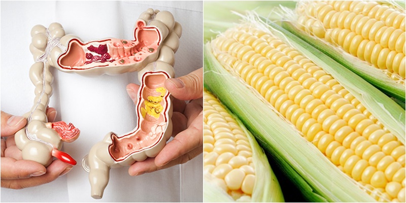 Người mắc các bệnh liên quan đến hệ tiêu hóa ăn nhiều bắp làm bệnh tình thêm nặng hơn Người mắc các bệnh liên quan đến hệ tiêu hóa ăn nhiều bắp làm bệnh tình thêm nặng hơn