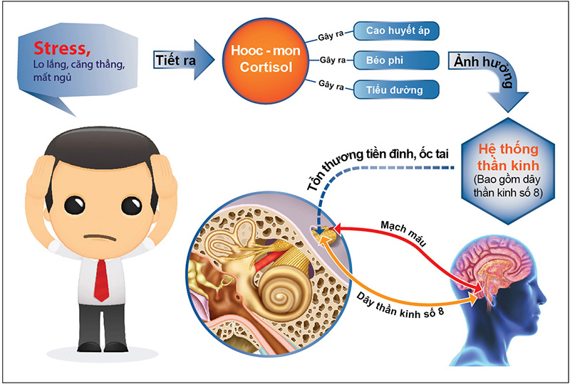 Nguyên nhân gây rối loạn tiền đình