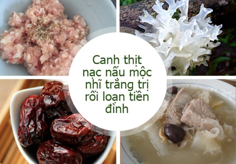 Điều trị rối loạn tiền đình