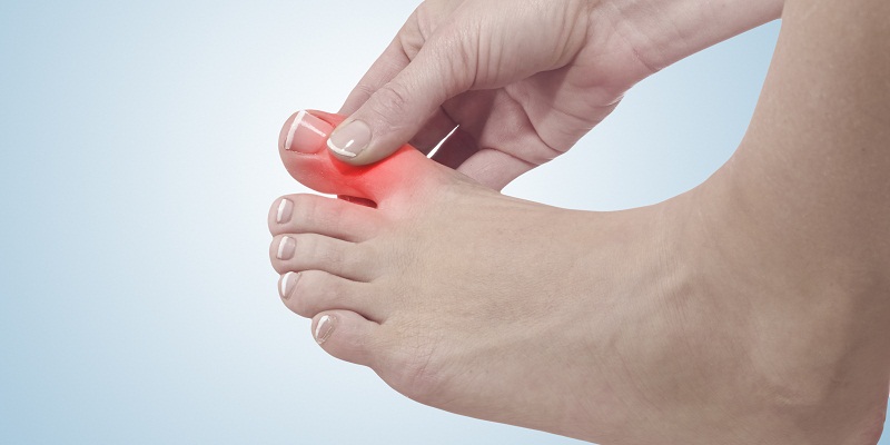 Mẹo giảm đau nhức cho người bệnh Gout