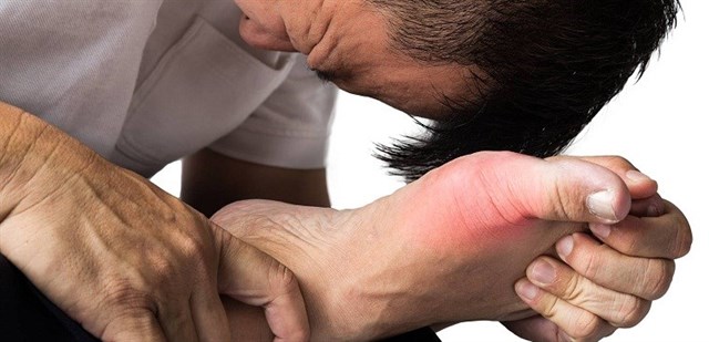 Mẹo giảm đau nhức cho người bệnh Gout