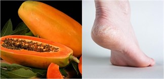 7 loại thực phẩm trị nứt gót chân tốt nhất