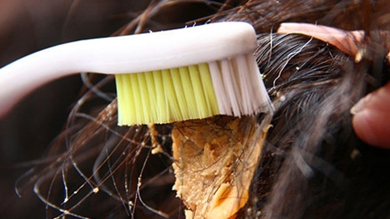 Mẹo đơn giản giải cứu tóc khỏi bã kẹo cao su