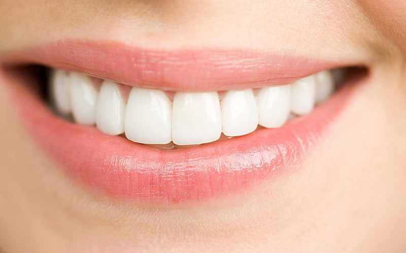 Tính chất kháng khuẩn của dầu dừa giúp ngăn chặn được một số vấn đề về răng thông thường