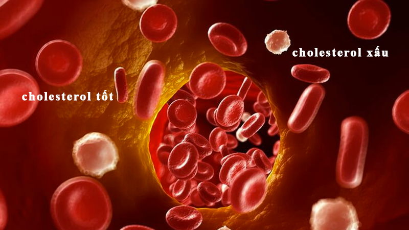 Chiết xuất tỏi đen có thể làm tăng HDL (cholesterol tốt) và giảm LDL (cholesterol xấu)