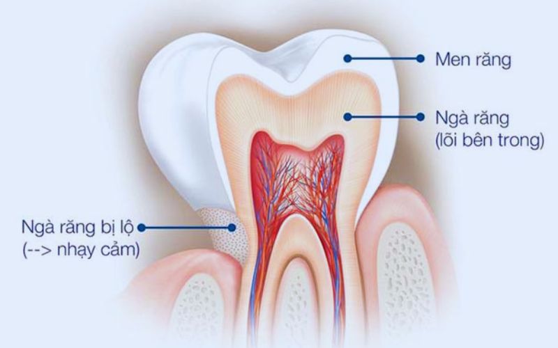 Men răng là gì?