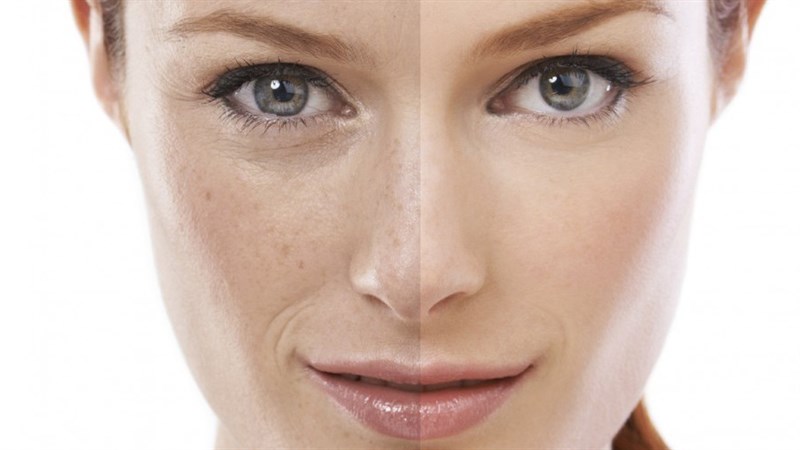 Mách bạn lợi ích tuyệt vời của ca cao đối với làn da