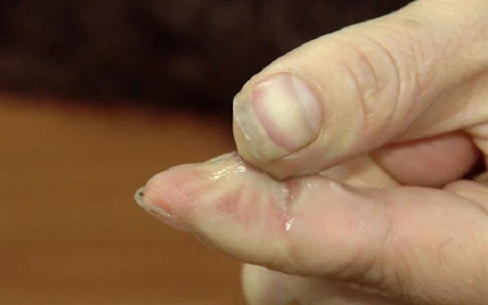Tips to easily remove 502 glue from your hands