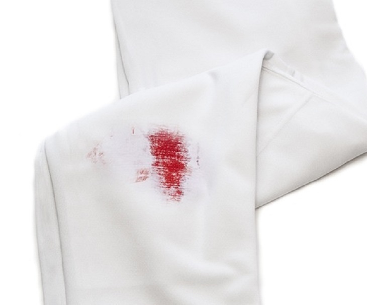 Blood stains on clothes