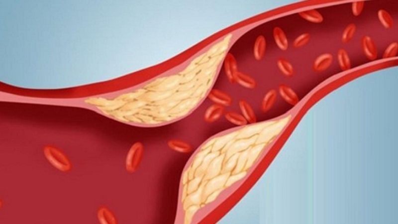 Trà nụ vối giảm cholesterol máu