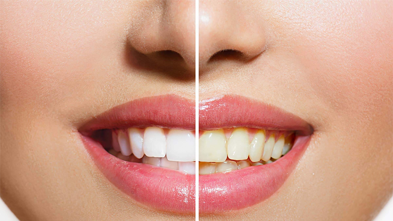 Bột than hoạt tính có tác dụng làm trắng răng Bột than hoạt tính có tác dụng làm trắng răng