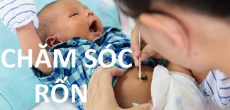 Hướng dẫn cách chăm sóc rốn cho bé