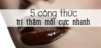Bỏ túi 5 bí quyết trị thâm môi tại nhà không phải ai cũng biết