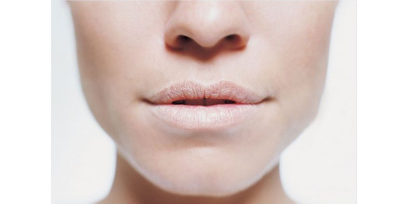 Đoán bệnh qua màu sắc của môi để biết gặp tình trạng gì về sức khoẻ