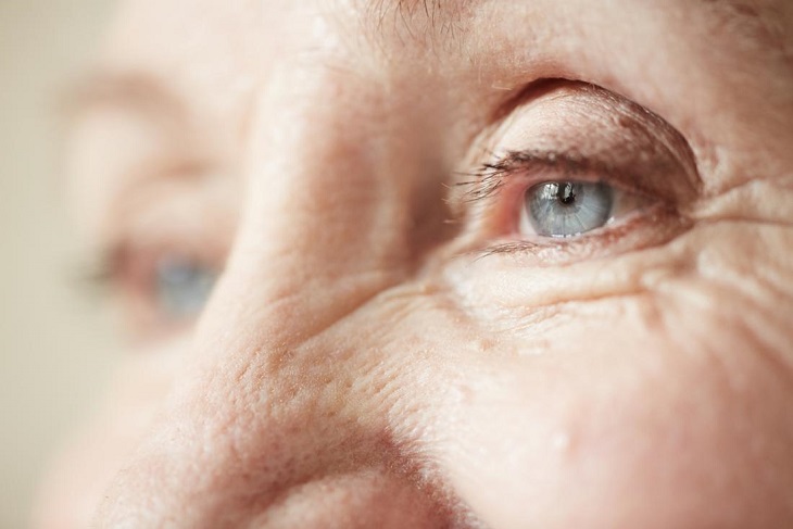 Image: People with eye diseases should not use black garlic