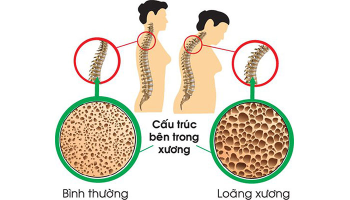 Đọc bài viết này xong bạn sẽ phải từ bỏ ngay thói quen ăn mặn